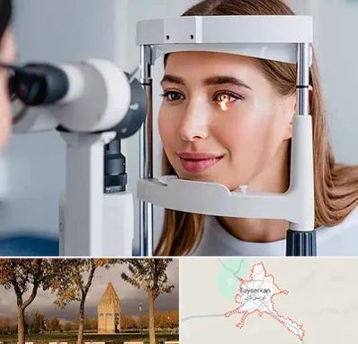 دکتر چشم پزشک خوب در تویسرکان