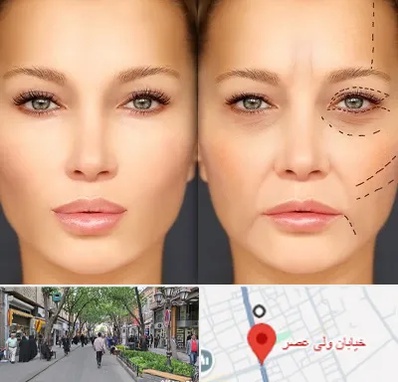 متخصص زیبایی چشم در ولیعصر شهریار