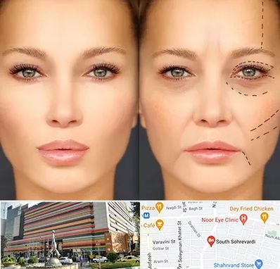 متخصص زیبایی چشم در سهروردی 