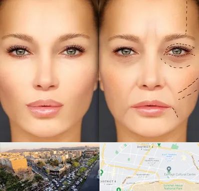 متخصص زیبایی چشم در تهرانپارس 