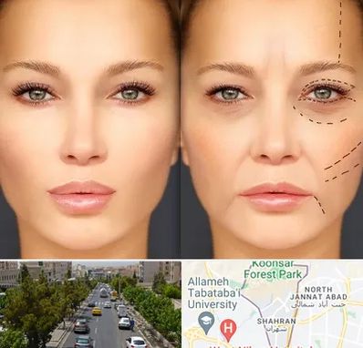 متخصص زیبایی چشم در شهران 