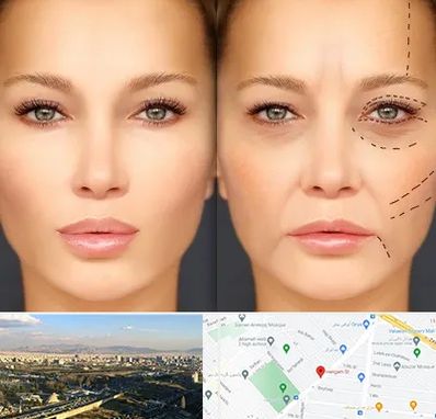 متخصص زیبایی چشم در هنگام 