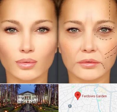 متخصص زیبایی چشم در باغ فردوس