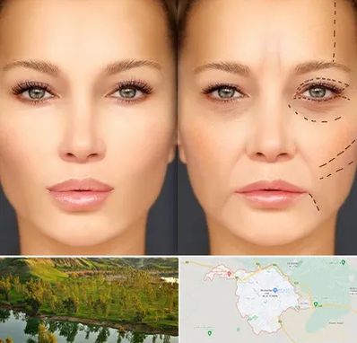 متخصص زیبایی چشم در بهبهان