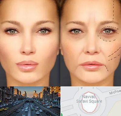 متخصص زیبایی چشم در نواب