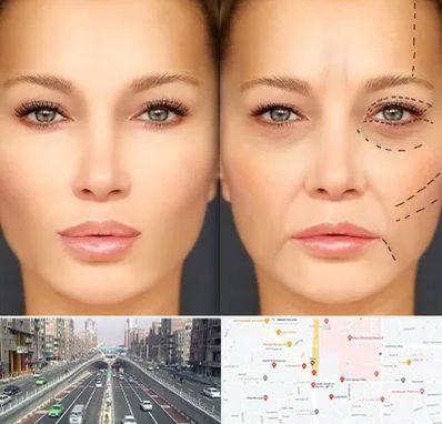 متخصص زیبایی چشم در توحید 