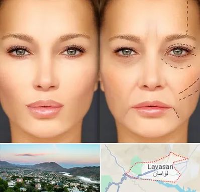 متخصص زیبایی چشم در لواسان