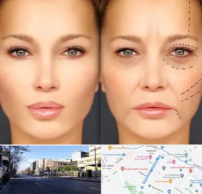 متخصص زیبایی چشم در خیابان ملاصدرا شیراز