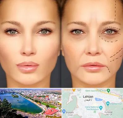 متخصص زیبایی چشم در لاهیجان