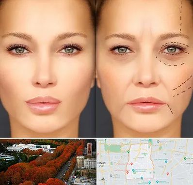 متخصص زیبایی چشم در منطقه 6 تهران 