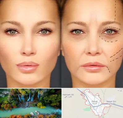 متخصص زیبایی چشم در دورود