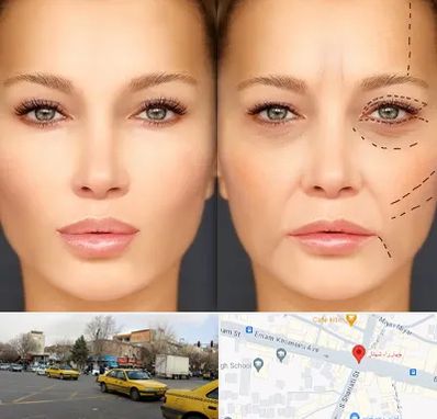 متخصص زیبایی چشم در شهناز تبریز