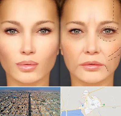 متخصص زیبایی چشم در بندر ماهشهر