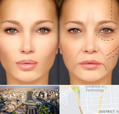 متخصص زیبایی چشم در استاد معین 