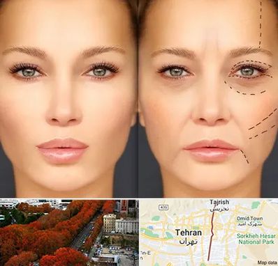 متخصص زیبایی چشم در ولیعصر 