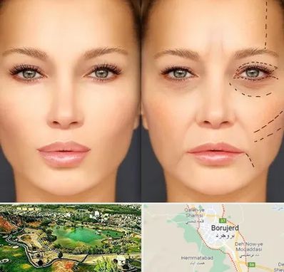 متخصص زیبایی چشم در بروجرد