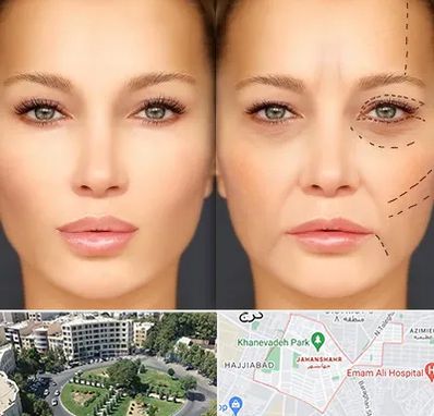 متخصص زیبایی چشم در جهانشهر کرج 