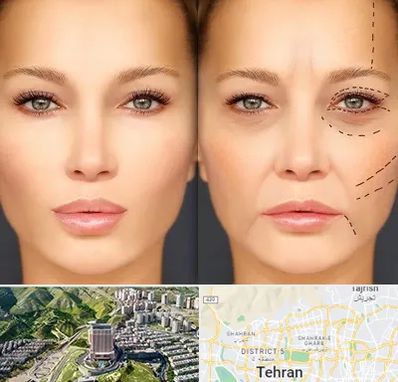 متخصص زیبایی چشم در شمال تهران 