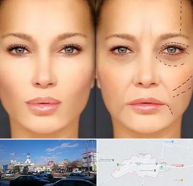 متخصص زیبایی چشم در ماهدشت کرج 