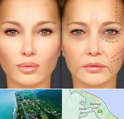 متخصص زیبایی چشم در رامسر