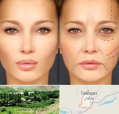 متخصص زیبایی چشم در طالقان