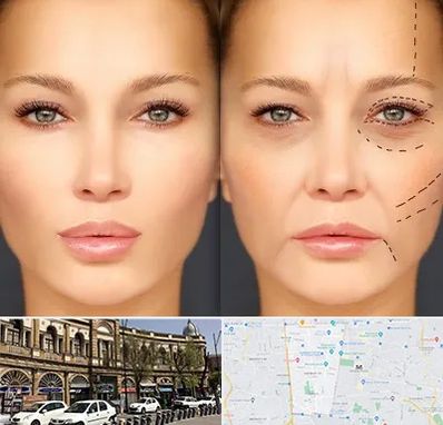 متخصص زیبایی چشم در منطقه 11 تهران 