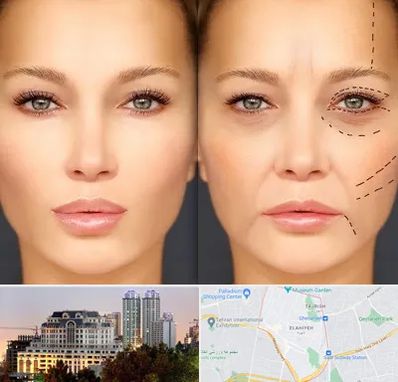 متخصص زیبایی چشم در فرشته 