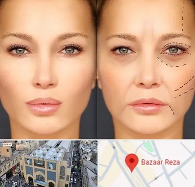 متخصص زیبایی چشم در بازار رضا مشهد