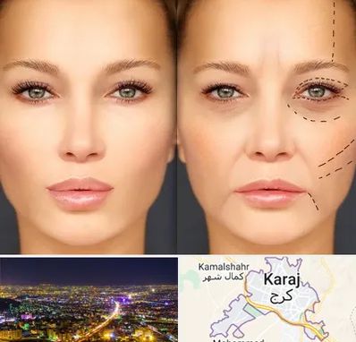 متخصص زیبایی چشم در کرج