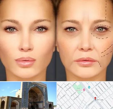 متخصص زیبایی چشم در مصلی مشهد