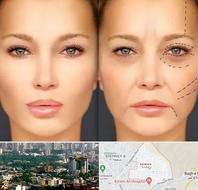 متخصص زیبایی چشم در عظیمیه کرج 