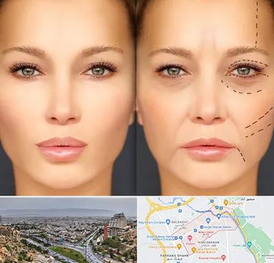 متخصص زیبایی چشم در معالی آباد شیراز