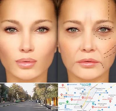 متخصص زیبایی چشم در شریعتی 