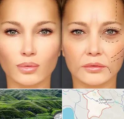 متخصص زیبایی چشم در گچساران