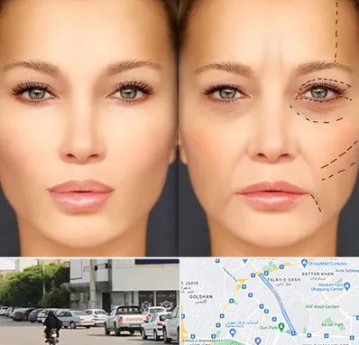 متخصص زیبایی چشم در قدوسی شرقی شیراز