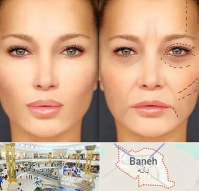 متخصص زیبایی چشم در بانه