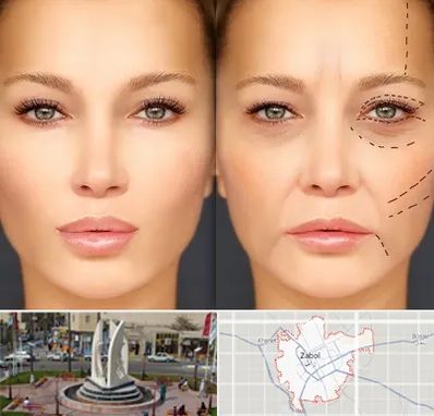 متخصص زیبایی چشم در زابل