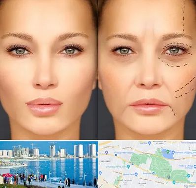 متخصص زیبایی چشم در چیتگر 