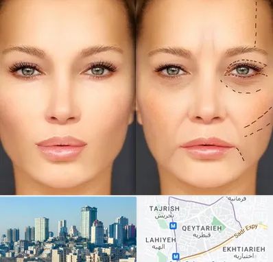 متخصص زیبایی چشم در قیطریه 