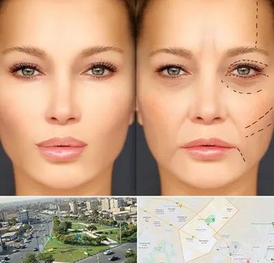 متخصص زیبایی چشم در کمال شهر کرج 