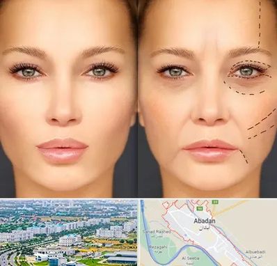 متخصص زیبایی چشم در آبادان