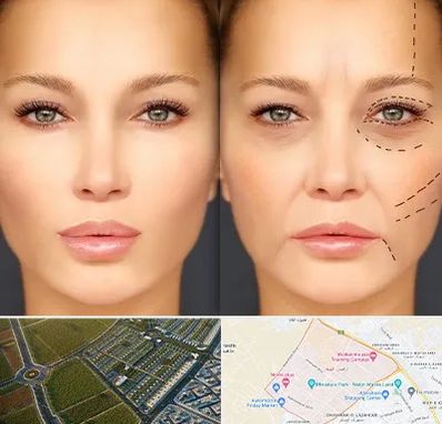 متخصص زیبایی چشم در الهیه مشهد