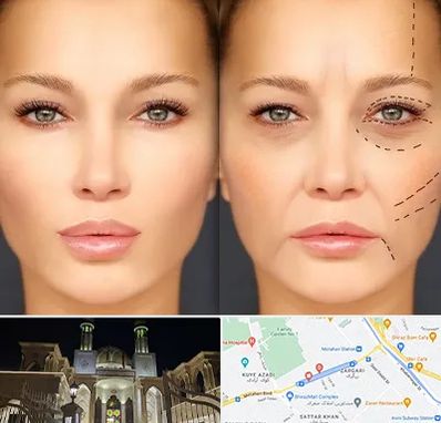 متخصص زیبایی چشم در زرگری شیراز