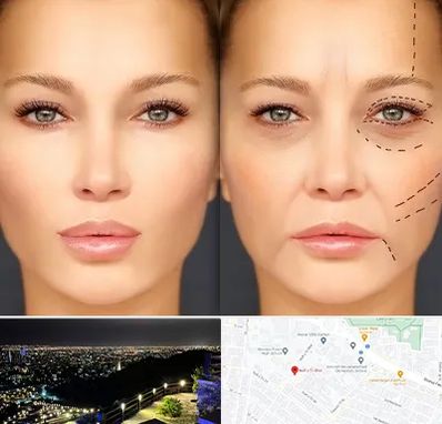 متخصص زیبایی چشم در هفت تیر مشهد 