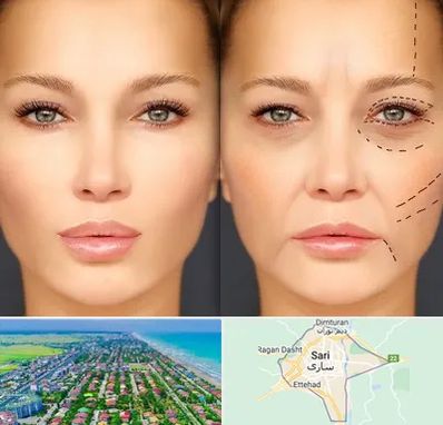 متخصص زیبایی چشم در ساری