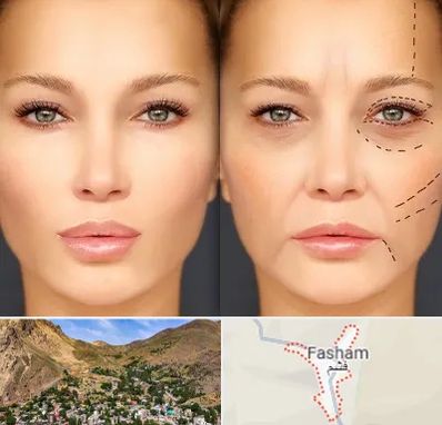 متخصص زیبایی چشم در فشم