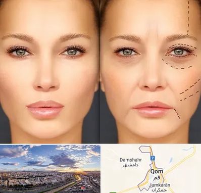 متخصص زیبایی چشم در قم