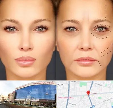 متخصص زیبایی چشم در نصف راه تبریز