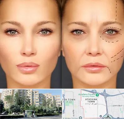 متخصص زیبایی چشم در آپادانا