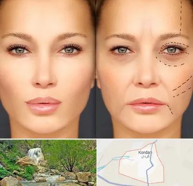 متخصص زیبایی چشم در کردان